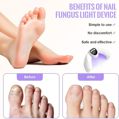 Nail Cleaning Laser Device