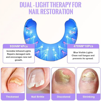 Nail Cleaning Laser Device